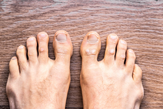 "Why Foot Hygiene Is Critical for Fungus-Free Nails"