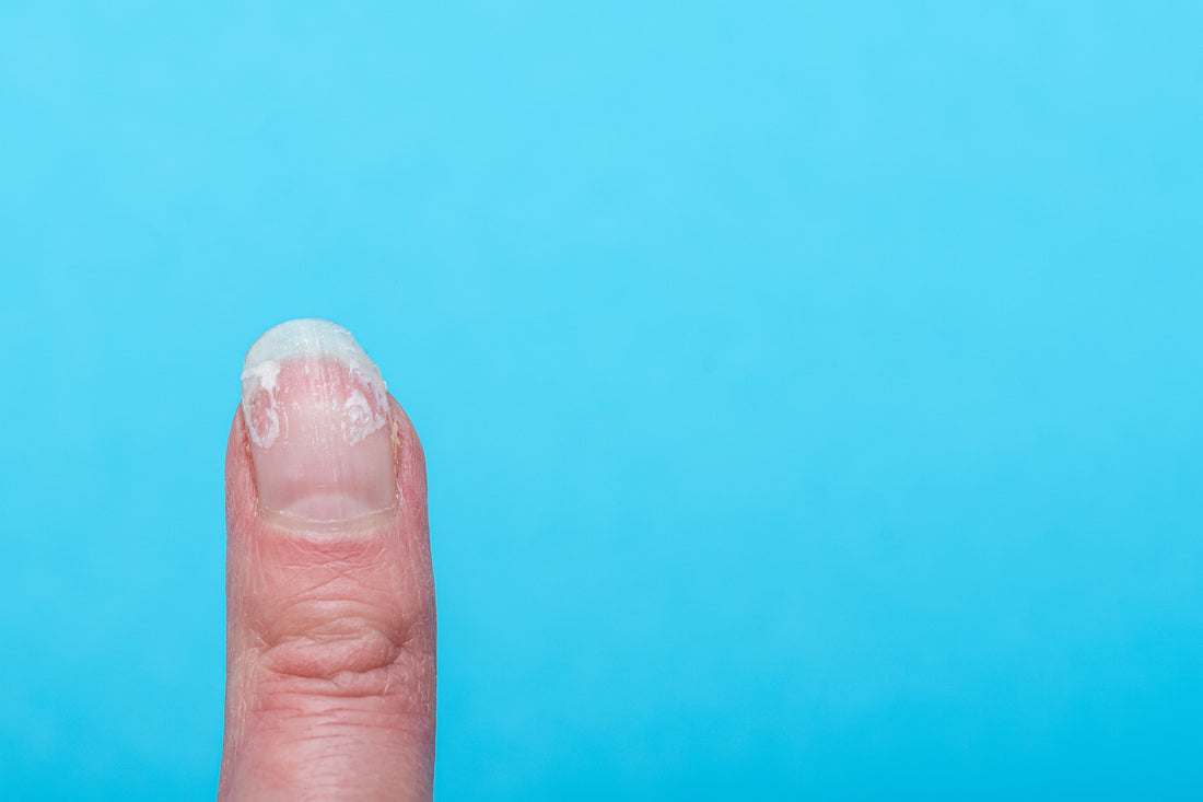 5. "Tips to Keep Your Feet and Nails Clean, Healthy, and Fungus-Free"