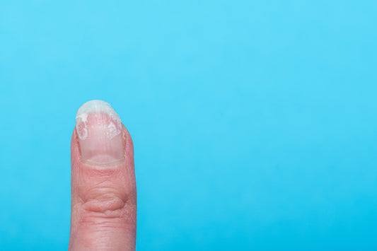 5. "Tips to Keep Your Feet and Nails Clean, Healthy, and Fungus-Free"